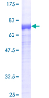 ECSIT Protein - 12.5% SDS-PAGE of human ECSIT stained with Coomassie Blue