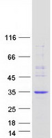 ECSIT Protein - Purified recombinant protein ECSIT was analyzed by SDS-PAGE gel and Coomassie Blue Staining