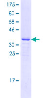 ECT2 Protein - 12.5% SDS-PAGE Stained with Coomassie Blue.