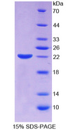 ECT2 Protein - Recombinant Epithelial Cell Transforming Sequence 2 By SDS-PAGE