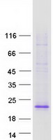 EDA / Ectodysplasin A Protein - Purified recombinant protein EDA was analyzed by SDS-PAGE gel and Coomassie Blue Staining
