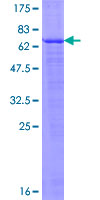 EDA2R / XEDAR Protein - 12.5% SDS-PAGE of human EDA2R stained with Coomassie Blue