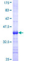 EDA2R / XEDAR Protein - 12.5% SDS-PAGE Stained with Coomassie Blue.