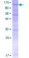 EDAG / HEMGN Protein - 12.5% SDS-PAGE of human HEMGN stained with Coomassie Blue