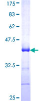EDAR Protein - 12.5% SDS-PAGE Stained with Coomassie Blue.