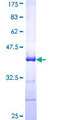 EDAR Protein - 12.5% SDS-PAGE Stained with Coomassie Blue.