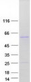 EDAR Protein - Purified recombinant protein EDAR was analyzed by SDS-PAGE gel and Coomassie Blue Staining
