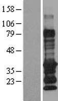 EDARADD Protein - Western validation with an anti-DDK antibody * L: Control HEK293 lysate R: Over-expression lysate