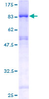 EDC3 Protein - 12.5% SDS-PAGE of human FLJ21128 stained with Coomassie Blue