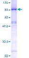 EDC3 Protein - 12.5% SDS-PAGE of human FLJ21128 stained with Coomassie Blue