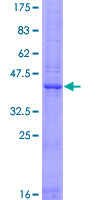 EDDM3A / FAM12A Protein - 12.5% SDS-PAGE of human FAM12A stained with Coomassie Blue