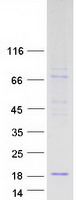 EDDM3B Protein - Purified recombinant protein EDDM3B was analyzed by SDS-PAGE gel and Coomassie Blue Staining