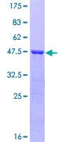 EDF1 / MBF1 Protein - 12.5% SDS-PAGE of human EDF1 stained with Coomassie Blue