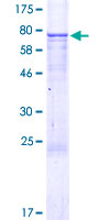 EDIL3 / DEL1 Protein - 12.5% SDS-PAGE of human EDIL3 stained with Coomassie Blue