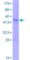 EDN1 / Endothelin 1 Protein - 12.5% SDS-PAGE of human EDN1 stained with Coomassie Blue