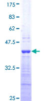 EDN1 / Endothelin 1 Protein - 12.5% SDS-PAGE Stained with Coomassie Blue.
