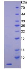 EDN1 / Endothelin 1 Protein - Recombinant Endothelin 1 By SDS-PAGE