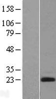 EDN2 / Endothelin 2 Protein - Western validation with an anti-DDK antibody * L: Control HEK293 lysate R: Over-expression lysate