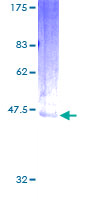 EDN2 / Endothelin 2 Protein - 12.5% SDS-PAGE of human EDN2 stained with Coomassie Blue
