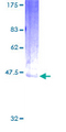 EDN2 / Endothelin 2 Protein - 12.5% SDS-PAGE of human EDN2 stained with Coomassie Blue