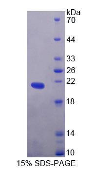 EDN2 / Endothelin 2 Protein - Recombinant  Endothelin 2 By SDS-PAGE