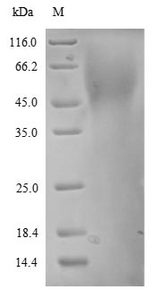 EDNRA / Endothelin A Receptor Protein - (Tris-Glycine gel) Discontinuous SDS-PAGE (reduced) with 5% enrichment gel and 15% separation gel. The reducing (R) protein migrates as 55 kDa in SDS-PAGE may be due to glycosylation.
