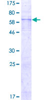 EDNRA / Endothelin A Receptor Protein - 12.5% SDS-PAGE of human EDNRA stained with Coomassie Blue