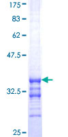 EDNRA / Endothelin A Receptor Protein - 12.5% SDS-PAGE Stained with Coomassie Blue.