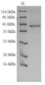 EDNRB / Endothelin B Receptor Protein - (Tris-Glycine gel) Discontinuous SDS-PAGE (reduced) with 5% enrichment gel and 15% separation gel.