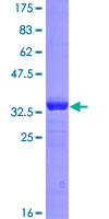 EDNRB / Endothelin B Receptor Protein - 12.5% SDS-PAGE Stained with Coomassie Blue.