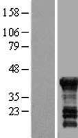 EDR / PEG10 Protein - Western validation with an anti-DDK antibody * L: Control HEK293 lysate R: Over-expression lysate