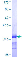EEA1 Protein - 12.5% SDS-PAGE Stained with Coomassie Blue.