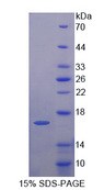 EEA1 Protein - Recombinant  Early Endosome Antigen 1 By SDS-PAGE