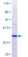 EED Protein - 12.5% SDS-PAGE Stained with Coomassie Blue.