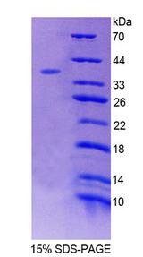 EED Protein - Recombinant Embryonic Ectoderm Development By SDS-PAGE