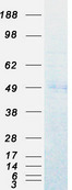 EED Protein - Purified recombinant protein EED was analyzed by SDS-PAGE gel and Coomassie Blue Staining