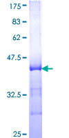 EEF1A1 Protein - 12.5% SDS-PAGE Stained with Coomassie Blue.