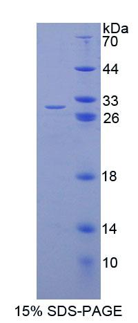 EEF1A1 Protein - Recombinant Eukaryotic Translation Elongation Factor 1 Alpha 1 By SDS-PAGE