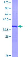 EEF1A2 Protein - 12.5% SDS-PAGE Stained with Coomassie Blue.