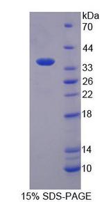EEF1A2 Protein - Recombinant Eukaryotic Translation Elongation Factor 1 Alpha 2 (EEF1a2) by SDS-PAGE