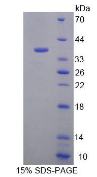 EEF1D Protein - Recombinant Eukaryotic Translation Elongation Factor 1 Delta (EEF1d) by SDS-PAGE