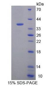 EEF1D Protein - Recombinant Eukaryotic Translation Elongation Factor 1 Delta (EEF1d) by SDS-PAGE
