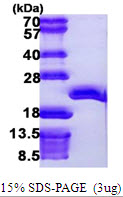 EEF1E1 / AIMP3 Protein