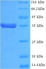 EEF1E1 / AIMP3 Protein