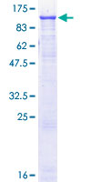 EEF2 / Elongation Factor 2 Protein - 12.5% SDS-PAGE of human EEF2 stained with Coomassie Blue