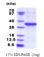 EEF2 / Elongation Factor 2 Protein