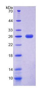 EEF2 / Elongation Factor 2 Protein - Recombinant Eukaryotic Translation Elongation Factor 2 By SDS-PAGE