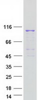 EEF2 / Elongation Factor 2 Protein - Purified recombinant protein EEF2 was analyzed by SDS-PAGE gel and Coomassie Blue Staining