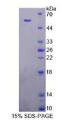 EEF2K Protein - Recombinant Eukaryotic Elongation Factor 2 Kinase (EEF2K) by SDS-PAGE