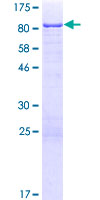 EEPD1 Protein - 12.5% SDS-PAGE of human EEPD1 stained with Coomassie Blue